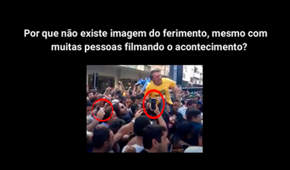 A Suposta Facada - Parte 1